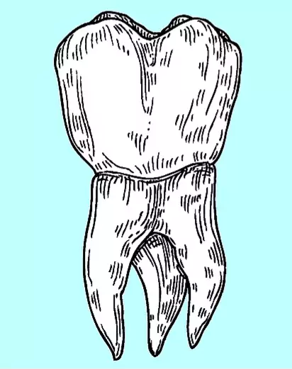 Molars